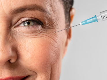 Rejuvenecimiento Facial con Botox: Mitos y Realidades